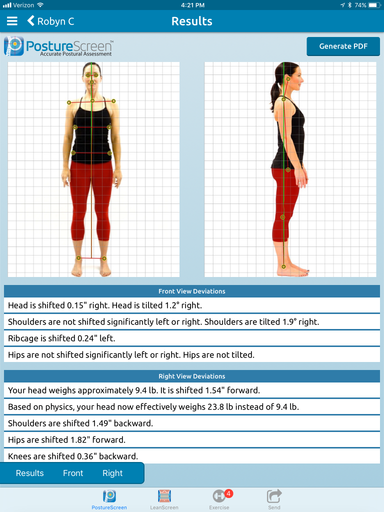 Why an upright posture is key to your health?, Upright 